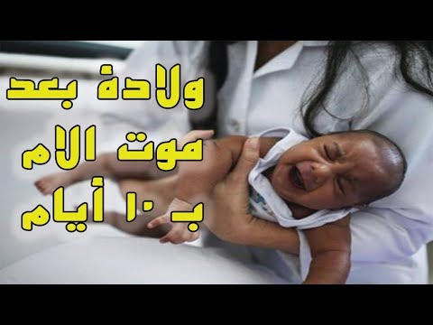 شاهد امرأة حامل تلد بعد وفاتها بـ10 أيام كاملة